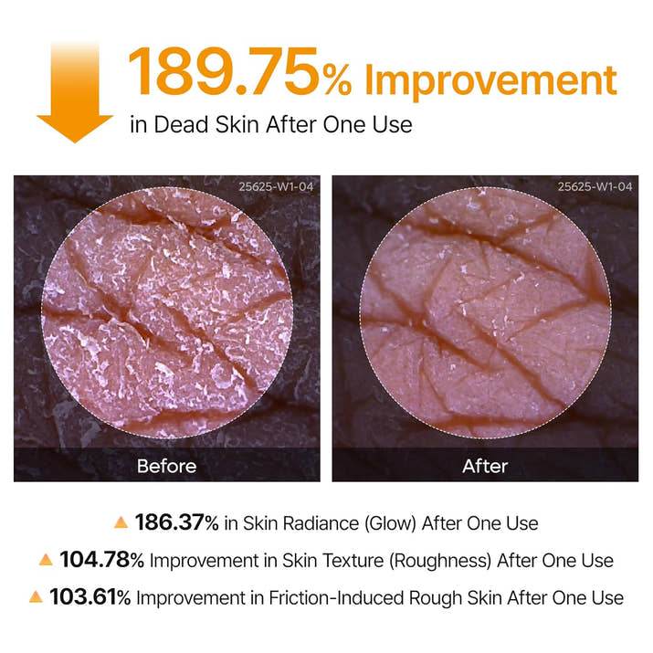 Dr.Melaxin Body Keratin Care Kojic Acid Turmeric Spray Gently Exfoliating Peeling Solution  Skincare All Skin Types 200ml