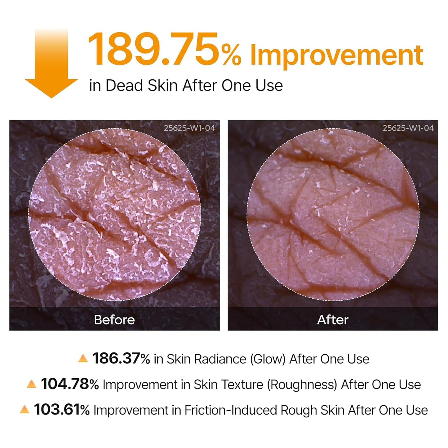 Dr.Melaxin Body Keratin Care Kojic Acid Turmeric Spray Gently Exfoliating Peeling Solution  Skincare All Skin Types 200ml