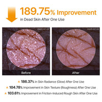 Dr.Melaxin Body Keratin Care Kojic Acid Turmeric Spray Gently Exfoliating Peeling Solution  Skincare All Skin Types 200ml